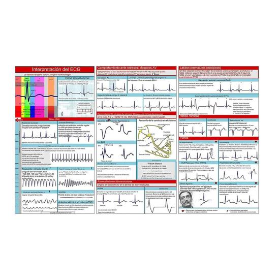 Карманный справочник ЭКГ Интерпретация ритма ЭКГ Двусторонняя карманная справочная карта Tri-Fold Study