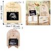 Wooden Stands Baby Ultrasound Frame Rustic Ultrasound Photo Frame Display Frame  Memory Display