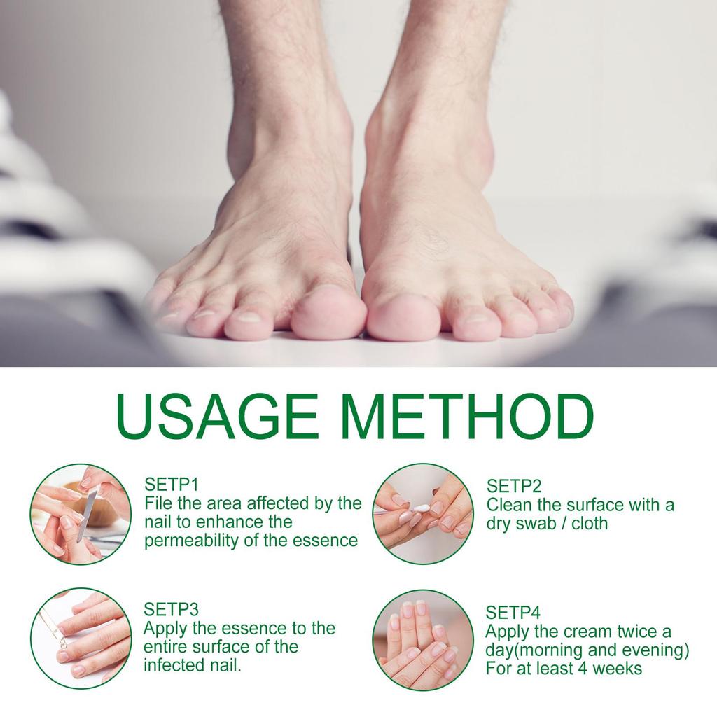 Jaysuing 7 Day Nail Care, Ginger Nail Care, Многоцелевое восстановление ногтей, Сыворотка для укрепления ногтей Масло