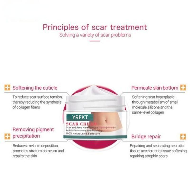 Глубоко проникающий крем для ухода за кожей кутикулы, прыщей, растяжек и шрамов