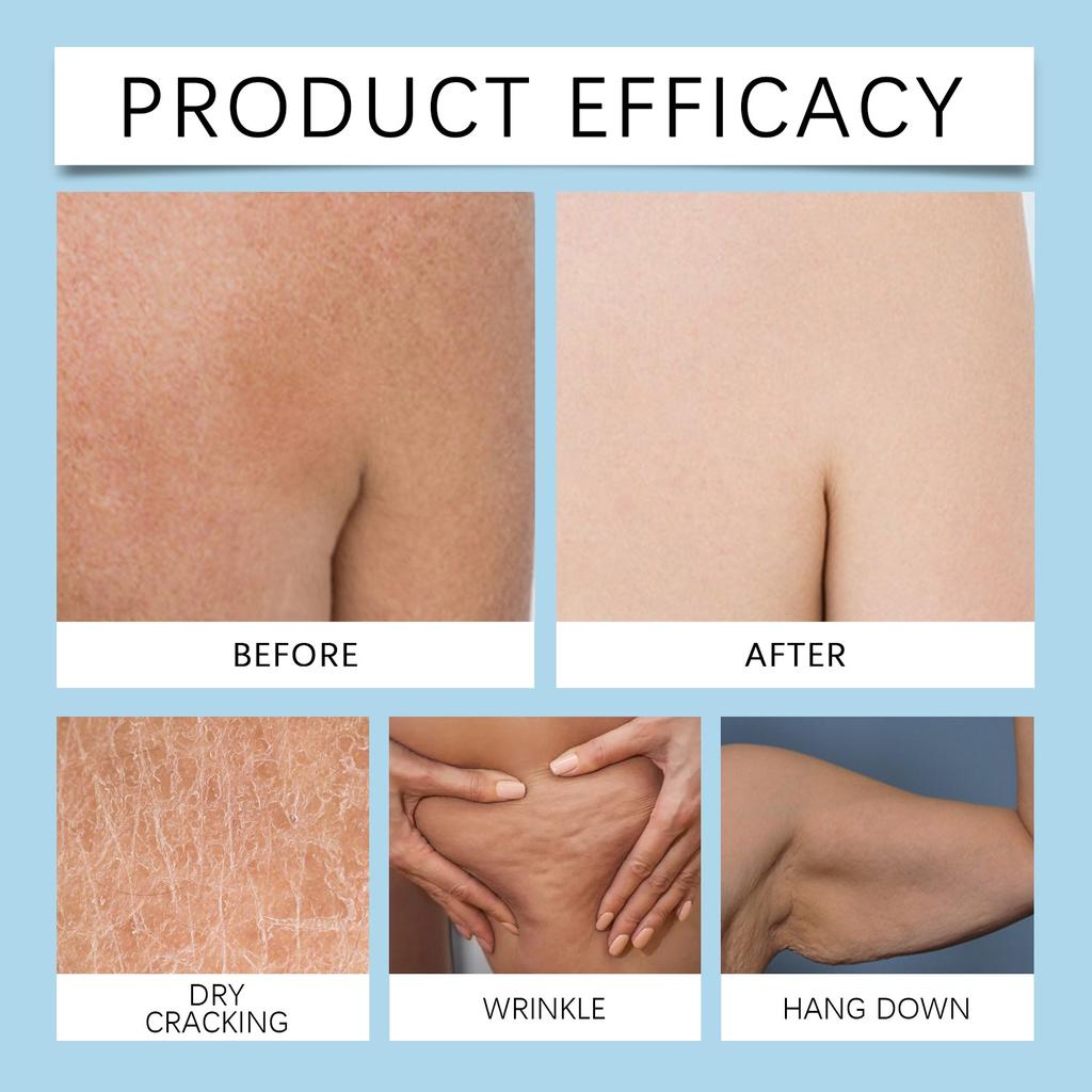 Compact And Light Wrinkle Body Moisturizer Gently Nourish Anti-dry Whitening Deep Hydrating Body Moisturizing Whitening