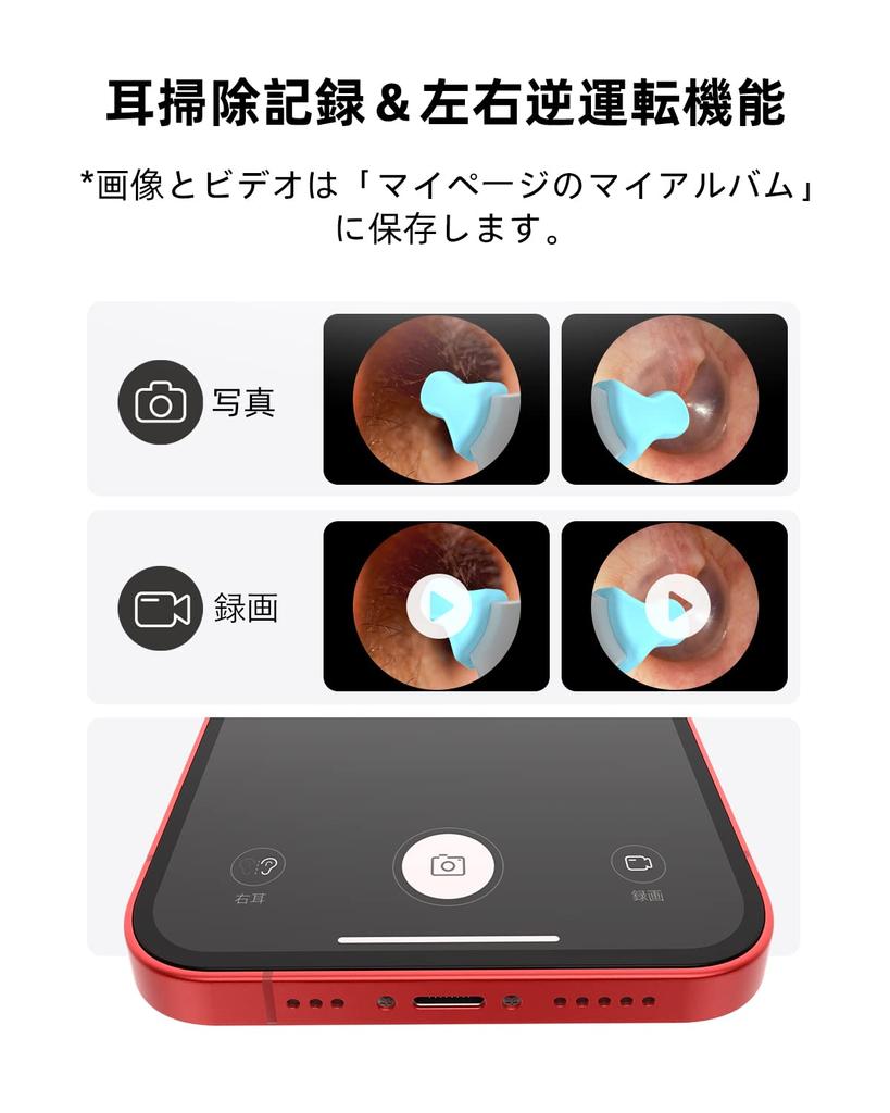 BEBIRDPRO Earpick Camera Earscope 1080P HD Image Quality Ultra Fine Lens Ear Cleaning Earpick with Light Earpick with Endoscope Smartphone Wireless