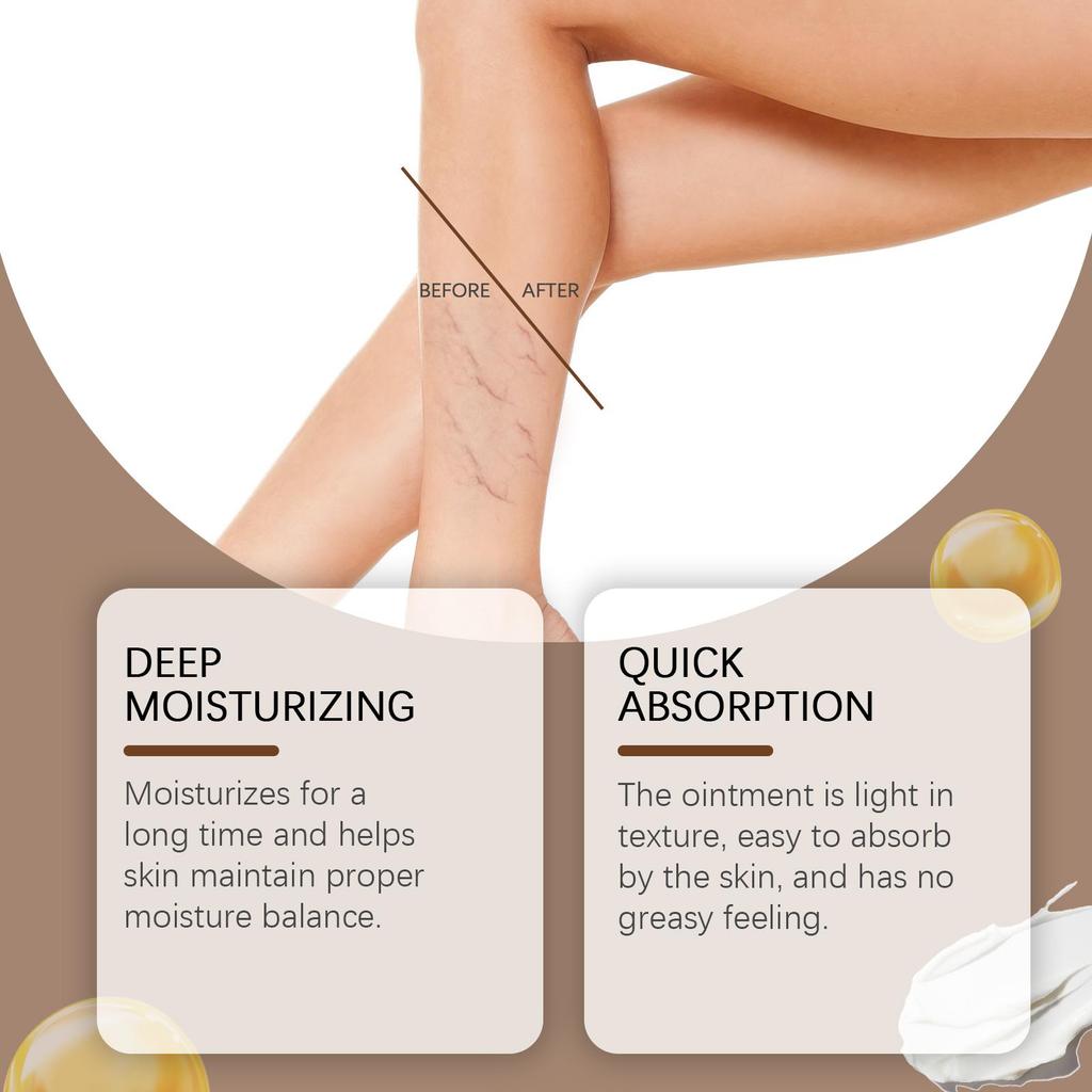 Мазь от варикозного расширения вен Устраняет сосудистые звездочки Облегчает васкулит Флебит Массаж Увлажняющий крем для ног для лечения боли
