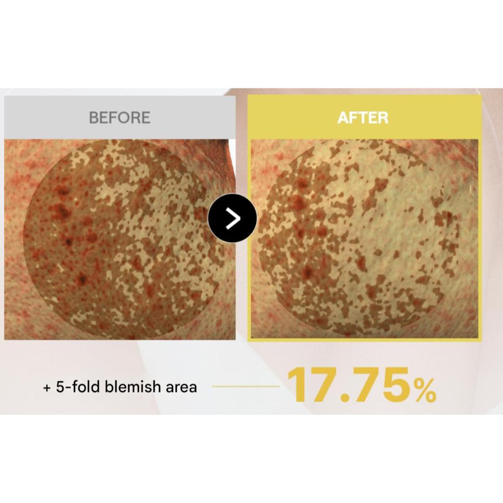 [Mediheal] Vitamin Bright Toning Pad 100ea + Refill 100ea