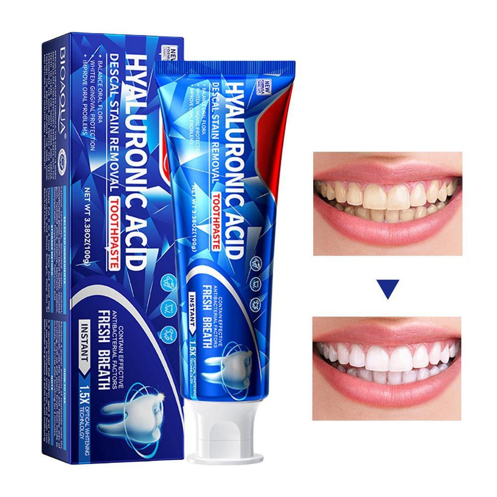 Зубная паста отбеливающая, глубоко очищающая зубная паста, отбеливающая зубная паста для взрослых с гиалуроновой кислотой, естественное отбеливание зубов
