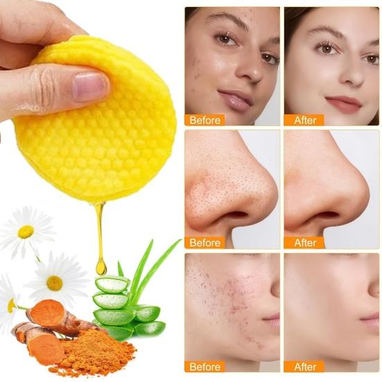 30/50 шт. очищающие диски с койевой кислотой для удаления темных пятен и макияжа, спрессованные спонжи для лица с куркумой, мягкое очищение пор, отшелушивание, очистка лица, хлопок