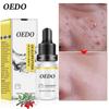 Oligopeptide Placenta Serum Face Cream Acne Treatment Skin Care Repair Whitening Anti Anging Winkles Essence Moisturizing