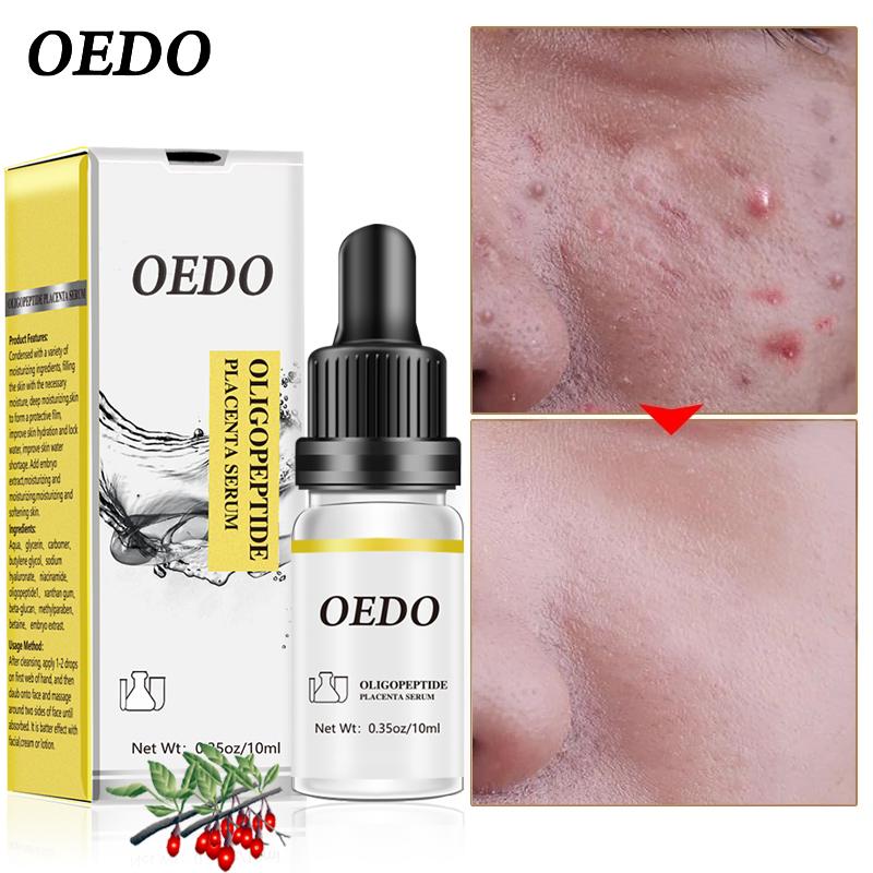 Oligopeptide Placenta Serum Face Cream Acne Treatment Skin Care Repair Whitening Anti Anging Winkles Essence Moisturizing