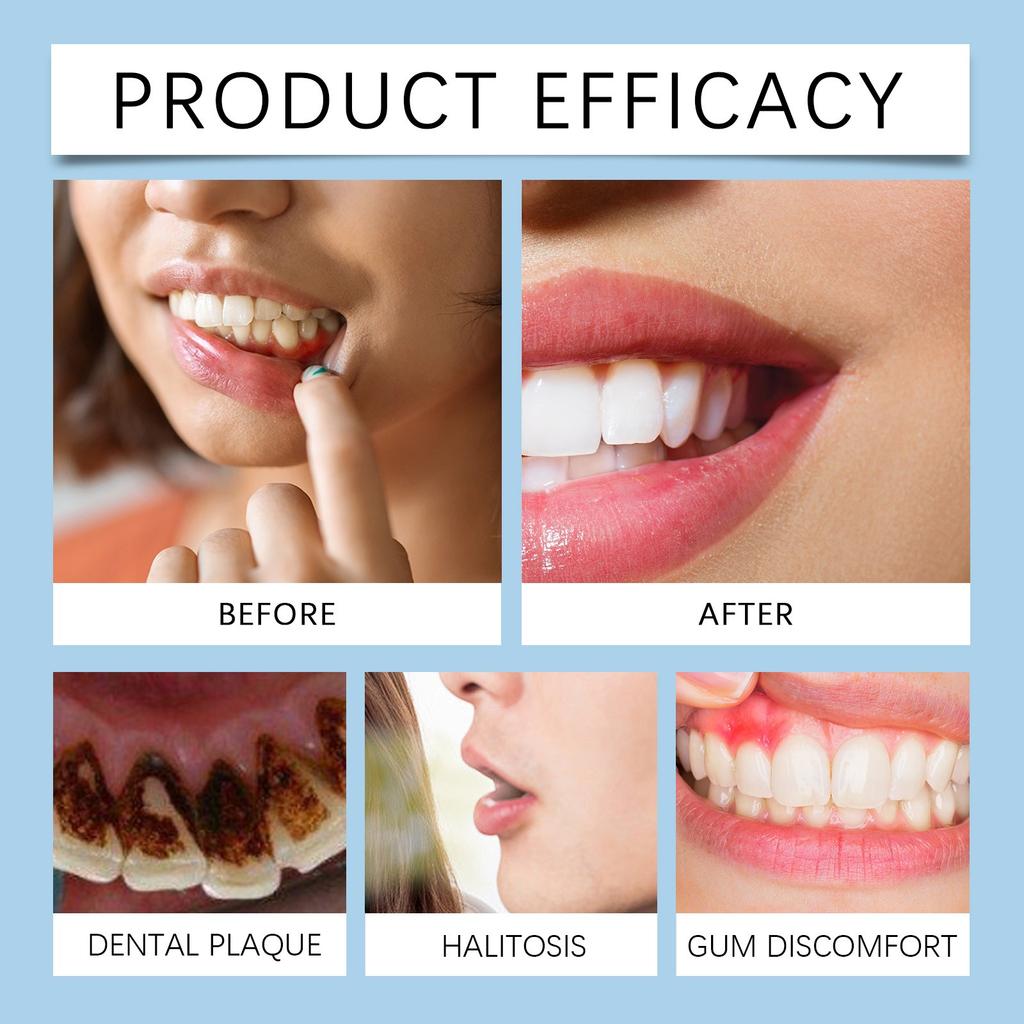 Спрей для ухода за полостью рта, обезболивающий спрей, средство от язв, эффективная профилактика зубной боли, 20 мл