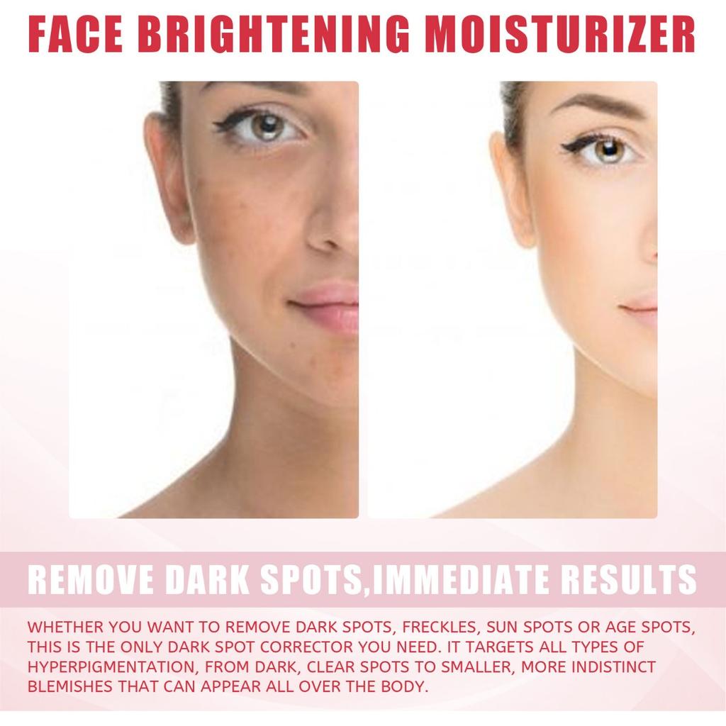 EELHOE 3-дневный увлажняющий крем с гиалуроновой кислотой - осветляет тон кожи, увлажняющий крем подтягивает и осветляет пятна