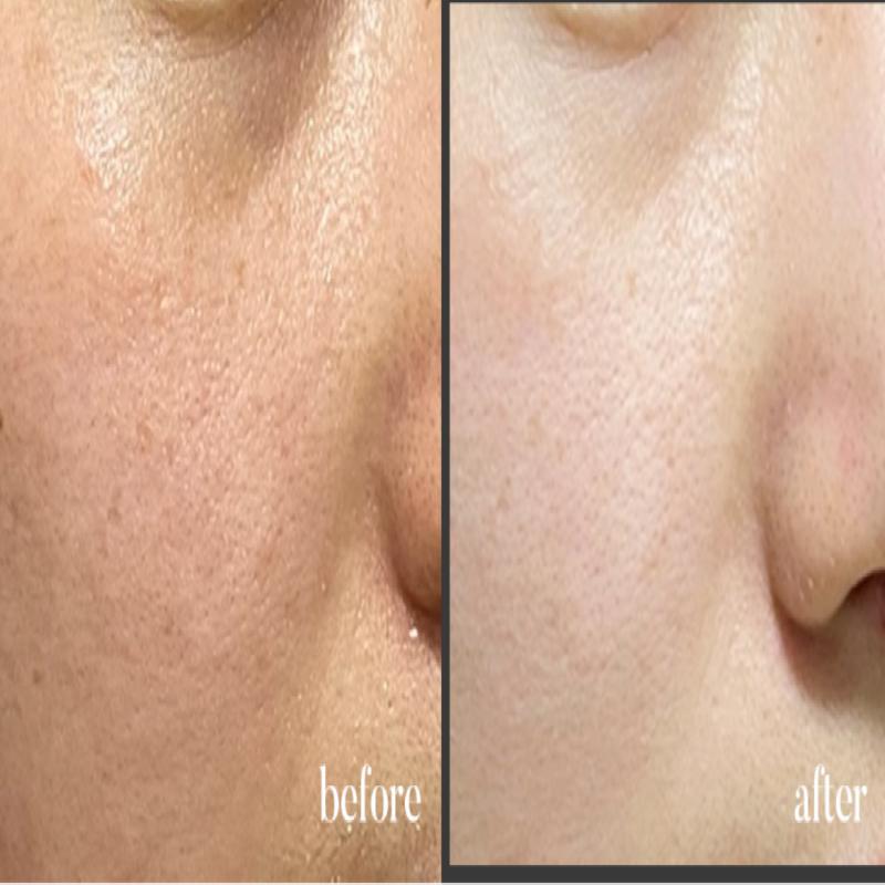 Shimoment Glutathione Pearl Whitening Beak-Ok Cream 50ml