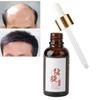 Daily scalp care, a fast-acting formula to promote hair growth, balances oil secretion, use 2-3 times daily 2pcs