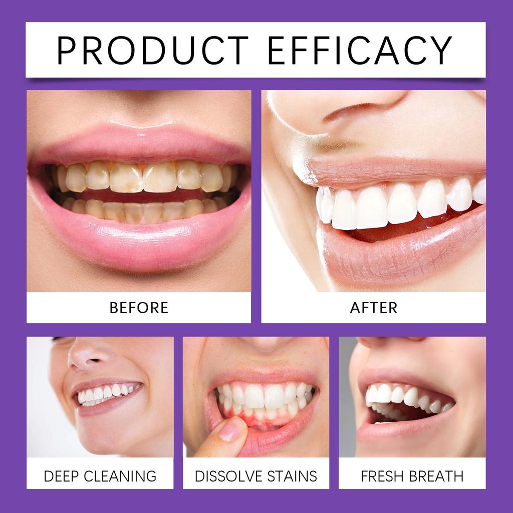 For Teeth Whitening,Whitening Toothpaste For Teeth Cleaning