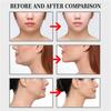 100PCS Invisible V Face Lift Sticker Fade Fine Lines Lift Tighten Jaw Muscle Shaper Patch Shrink Patch Invisible Stickers