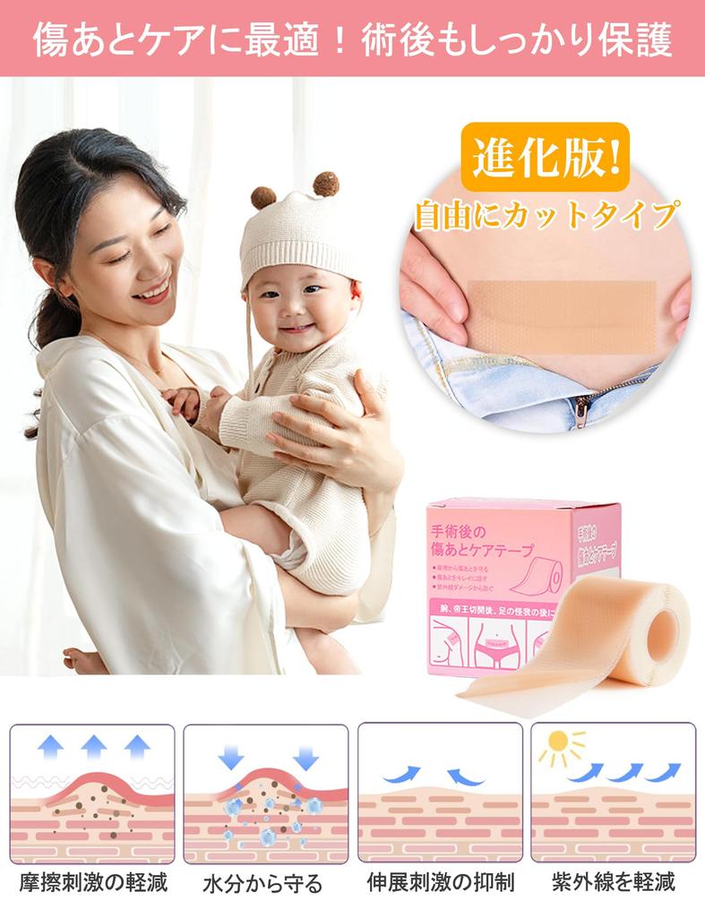 Лента для ухода за шрамами после кесарева сечения, келоидных шрамов, гипоаллергенная и нежная для кожи, для шрамов, силиконовая, настраиваемая, рекомендована дерматологами,