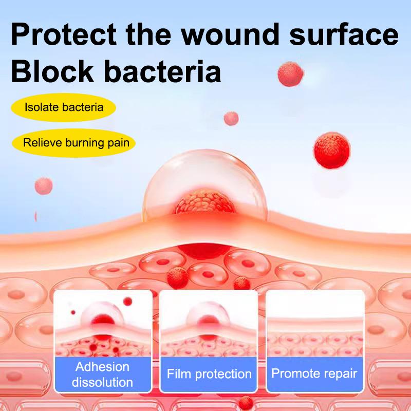 Патч для быстрого лечения язв во рту, повязка для ран полости рта при афтозном стоматите, быстрое облегчение боли, лекарство от афтозного стоматита, обезболивающее
