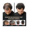 Shampooing activateur de racines pour hommes - Favorise la croissance et Ãpaissit les cheveux