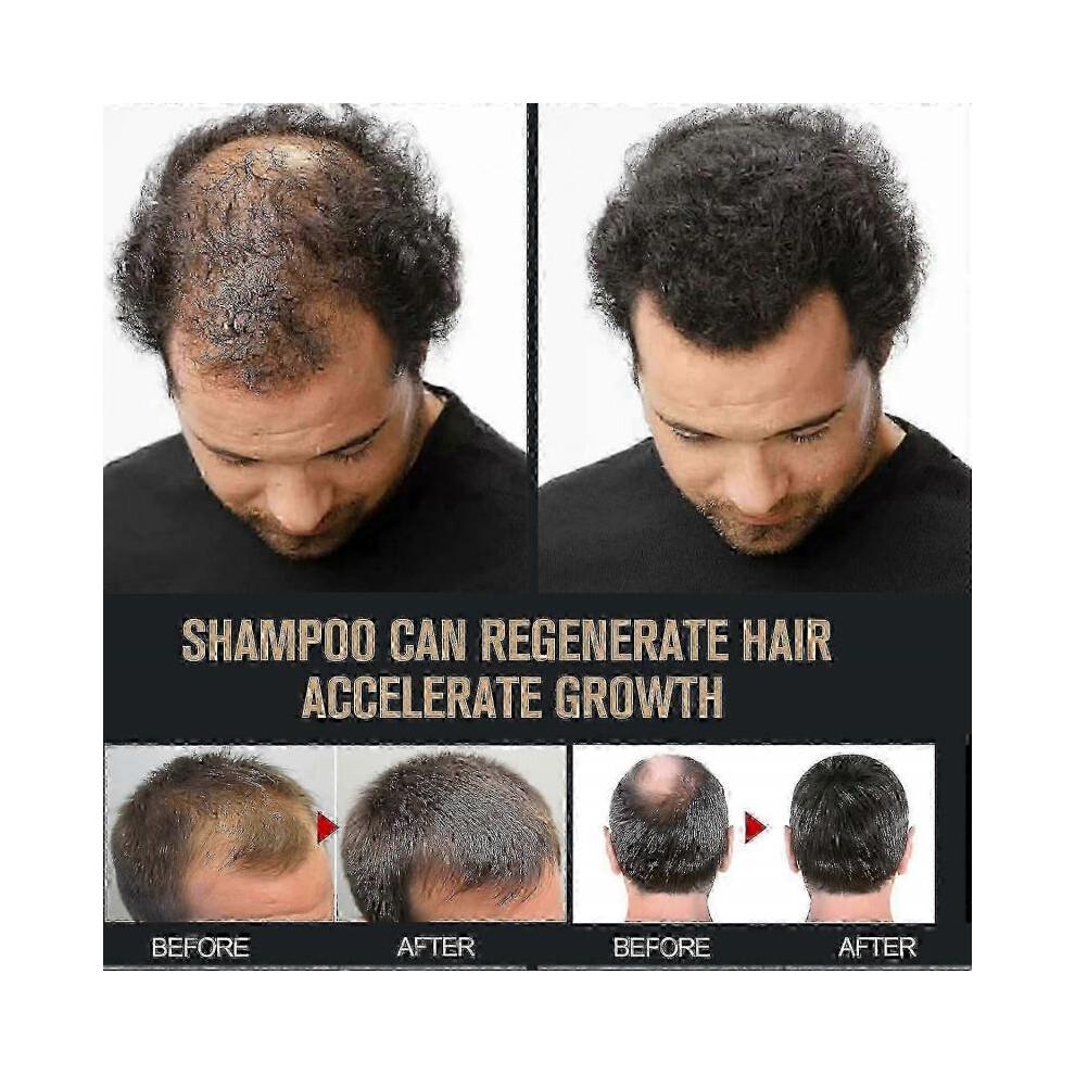 Shampooing activateur de racines pour hommes - Favorise la croissance et Ãpaissit les cheveux