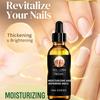 Раствор для восстановления ногтей Утолщающий, Осветляющий, Увлажняющий для ухода за ногтями