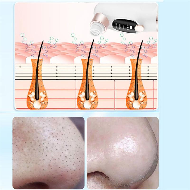 New Facial Cleanser Nose Acne Remover Face Pore Cleansing Tool Powerful Adsorption Exfoliation Deep Cleansing Beauty Tools