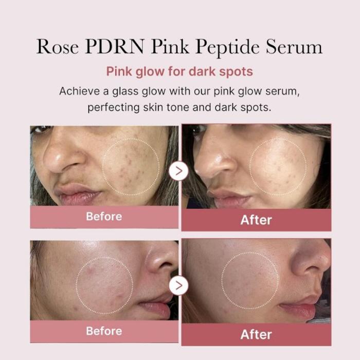 Medicube Коллагеновая сыворотка PDRN Pink Peptide 30 мл