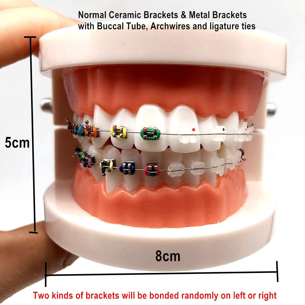 1 шт., стоматологическая модель для ухода за полостью рта, стоматологическая ортодонтическая модель для общения с пациентом, модель для исследования стоматолога
