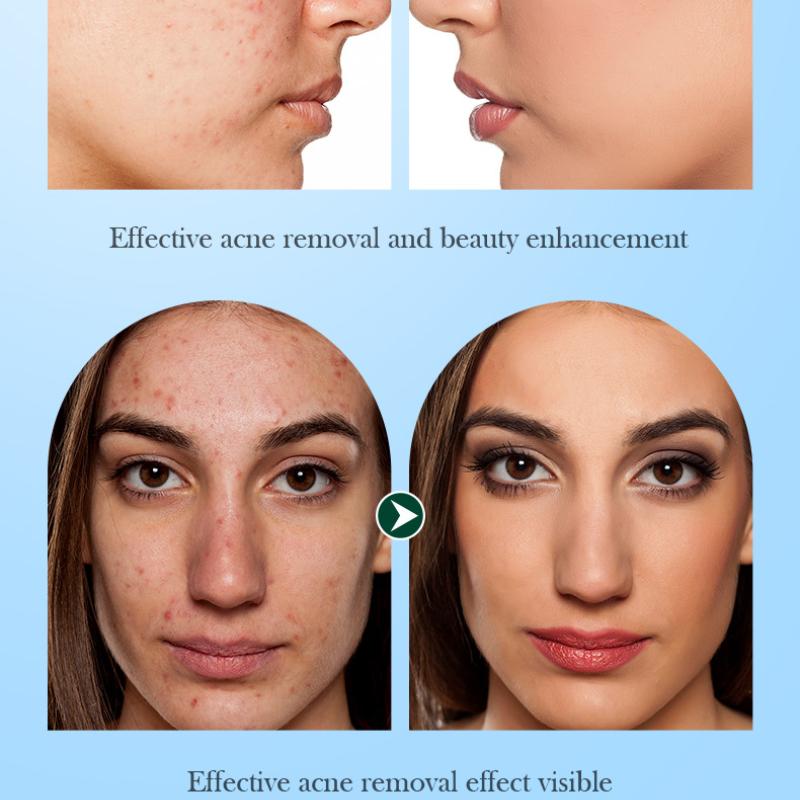 Tea Tree Mask 25g SADOER Refreshing Moisturizing Moisturizing Tablets