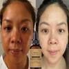 Face Whitening Essence Dark Spot Scar Whitening Oil Day and Night Essence Korean Whitening Skin Care Products