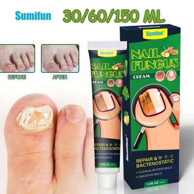 Sumifun 30/60/150 мл Крем для восстановления серых ногтей Облегчает серый цвет ногтей Утолщает Питает и увлажняет ногти Мазь