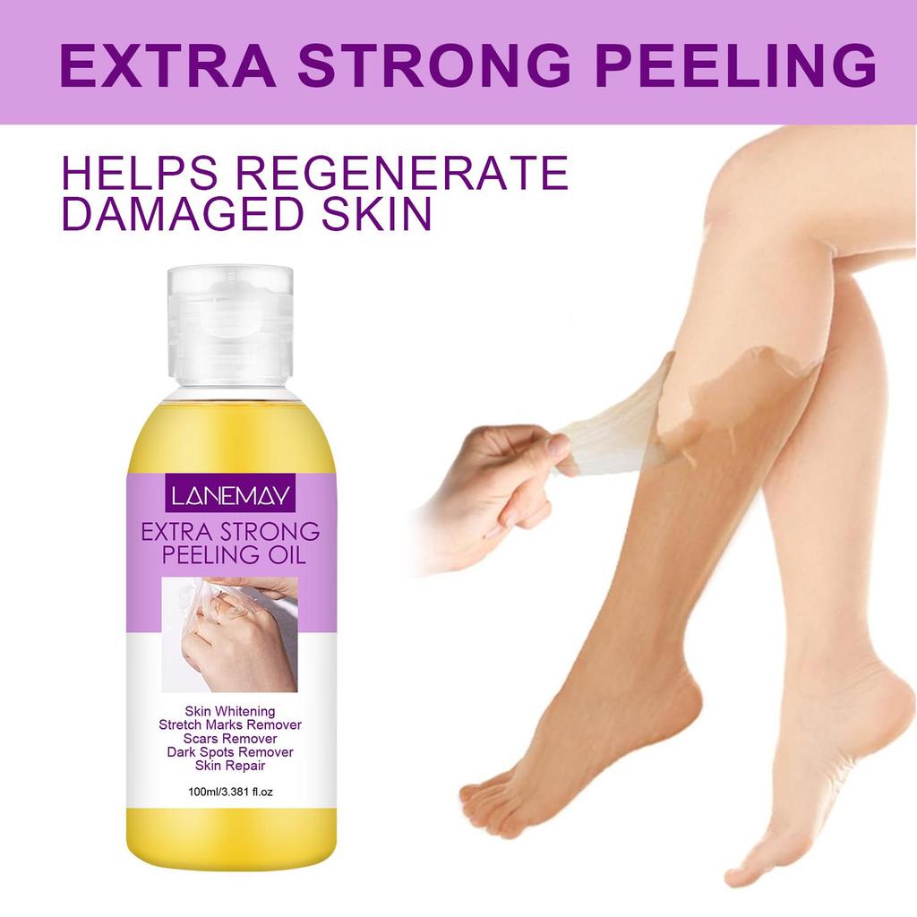 Очень сильный пилинг-масло-Отбеливание и восстановление кожи-Удаление растяжек и шрамов-Подходит для всех типов кожи, 100 мл