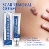 Крем от шрамов Пятна Разглаживание Укрепляющий Увлажняющий Осветление кожи Послеоперационный шрам Кожа Крем для заживления шрамов Уход за кожей
