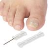 10 шт. 13-20 мм наклейки для коррекции ногтей, корректоры вросшего ногтя, пластыри для лечения паронихии, инструменты для педикюра для восстановления