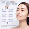Прибор для красоты лица от Beauty Expert EMS Beauty для красоты глаз и кожи, ультразвуковая имплантация ионов, домашняя косметическая процедура для и тела, красота линии лица
