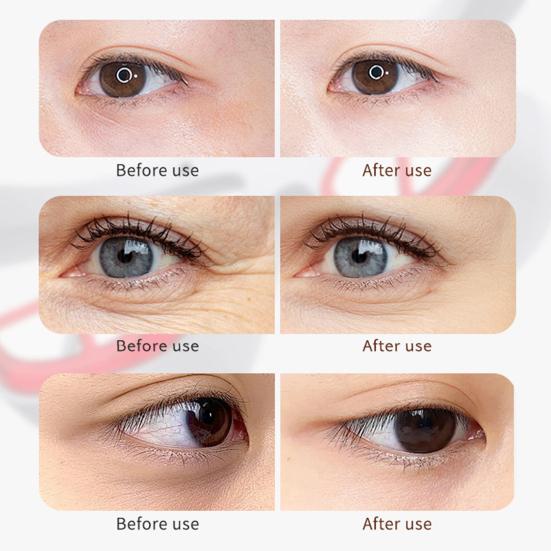 Очки для светотерапии красным светом Массажер для области под глазами Портативное устройство для ухода за глазами Светодиодный корректор для глаз для удаления морщин и подтяжки кожи