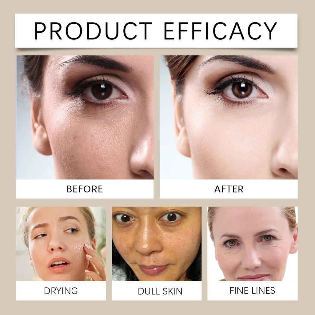 Beef Moisturizing Cream Nourishes And Moisturizes The Skin, Making It Soft And Smooth.