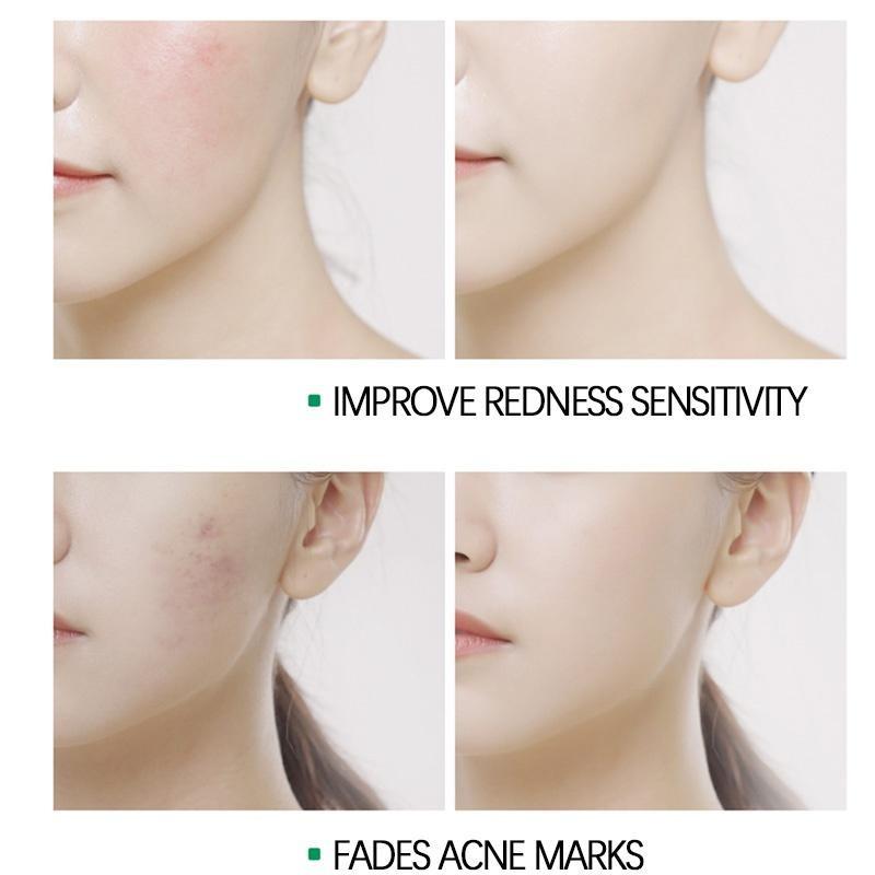 Крем с алоэ вера для лица, увлажняющий, восстанавливающий, осветляющий, уход за кожей лица