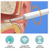 Визуальная беспроводная камера для чистки ушей, инструмент для удаления ушной серы, пинцет, средство для чистки ушей, удаление серы, набор эндоскопа для чистки ушной серы, ложка, ухочистка