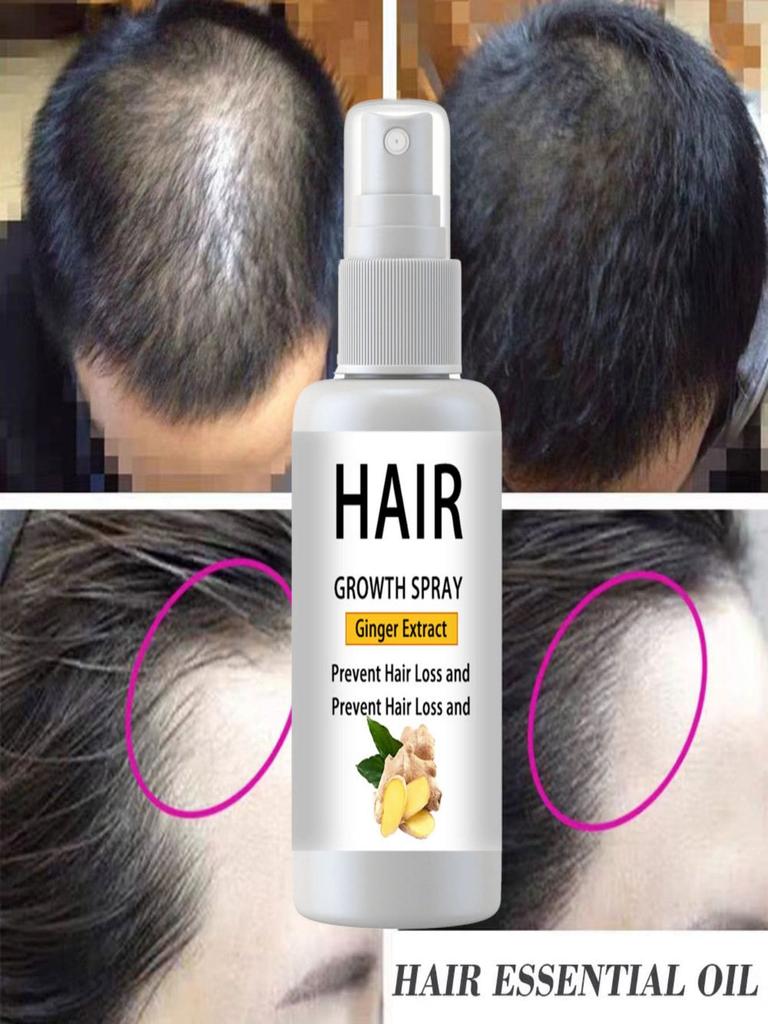 Hair Growth Product, Rosemary Growing Hair Essential Oil Beauty Hair Care, Prevent Hair Loss