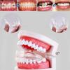 Dental Straightener Adult Fixed Silicone Braces Anti-Grinding Braces