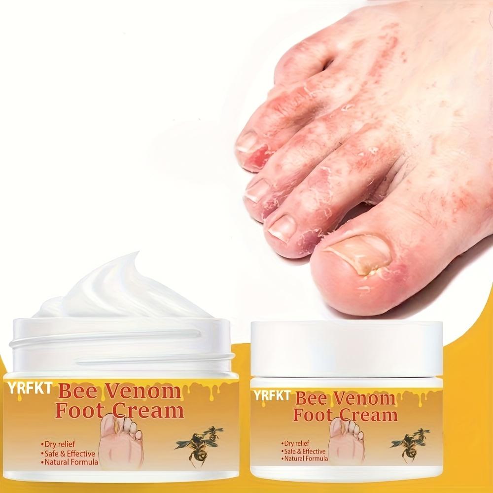 Bee Venom Foot Cream Deeply Cleanses the Feet, Prevents Dryness and Cracking, Effectively Moisturizes Dry Skin, and Prevents Peeling.
