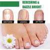 30ml Nail Repaird Solution, FootNail Tea-Tree Oil, Thick And Soft Nail Nutrition Hand And Foot Nail Care Solution