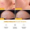 Plantifique Turmeric Vitamin C Face Mask, 110g, Oil Control & Moisturizing, Sensitive Skin, Brightening Nourishing Clay Mask