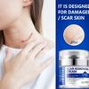 Pressure Type Scar Wrinkles, Burns, Caesarean Scar Fade Removal 50ML