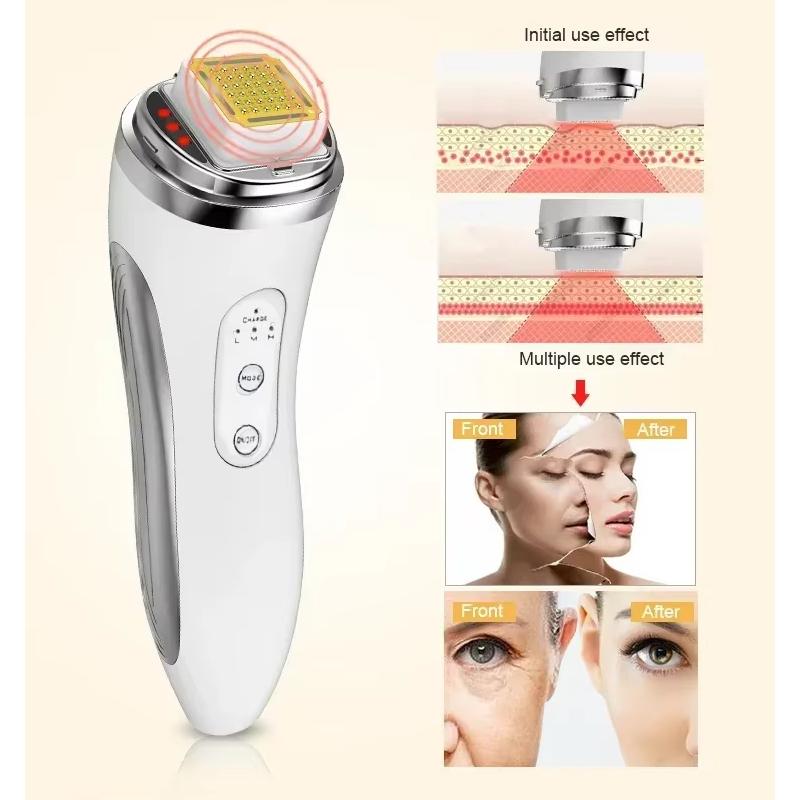 Радиочастотный лифтинг лица Rf Косметический прибор Подтяжка кожи, омоложение и удаление морщин Фракционный радиочастотный лифтинг лица