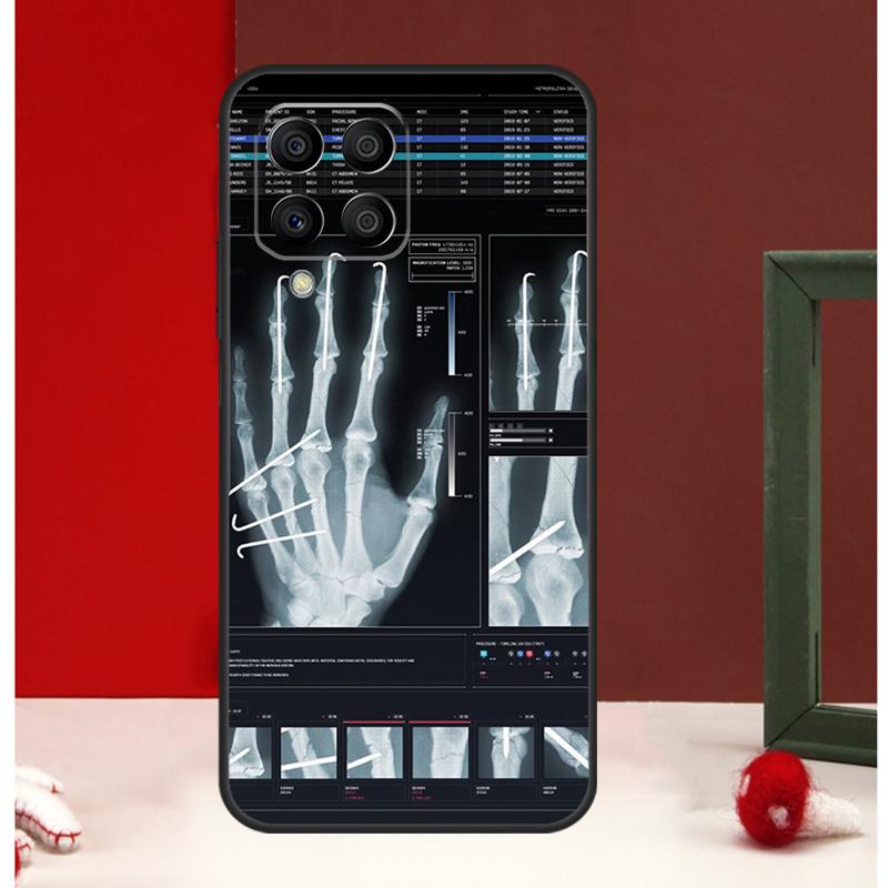Радиологический Человеческие Органы Скелет Чехла Для Samsung Galaxy M56 M36 M16 M31 M21 M13 M33 M53 M15 M35 M55 M12 M32 M52 M14 M34 M54
