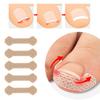 10Pcs Breathable Ingrown Toenail Correction Patches Stickers Self-Adhesive Nail Straightener Strips for Toenail Care