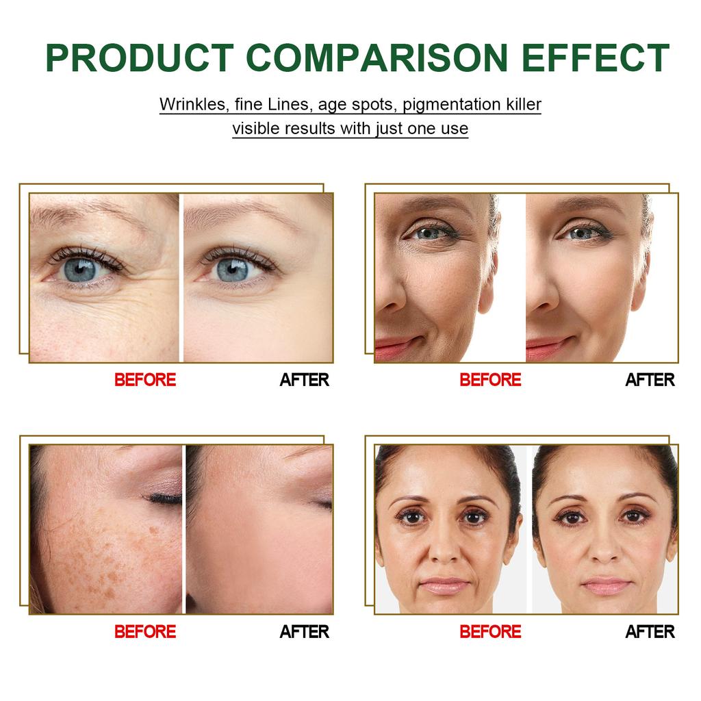 EELHOE Антивозрастная сыворотка для лица с коллагеном, сыворотка с гиалуроновой кислотой для удаления морщин, коллагеновый лифтинг, укрепляющая эссенция 3 шт. 5 мл