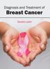 The Diagnosis and Treatment of Breast Cancer Book