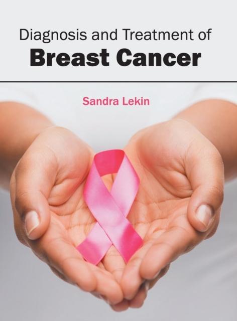 The Diagnosis and Treatment of Breast Cancer Book