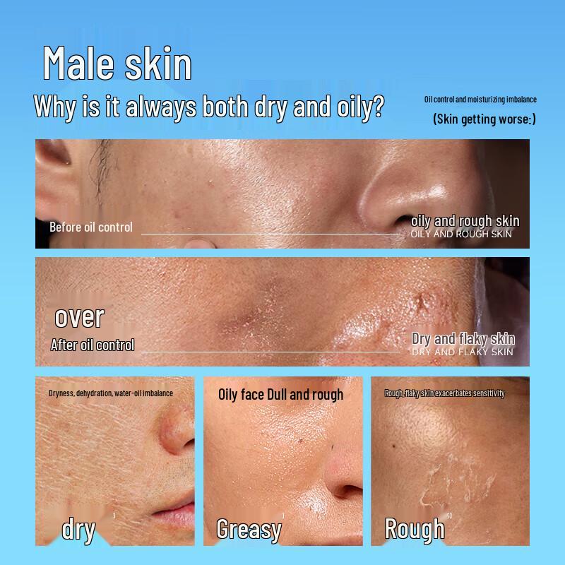 Zuo Yan You Se Micro-Acid Purifying Skincare Set